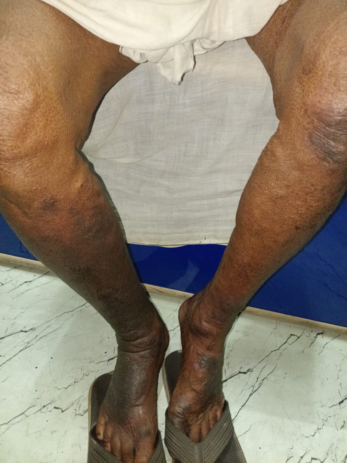 Patient progress during treatment documentation