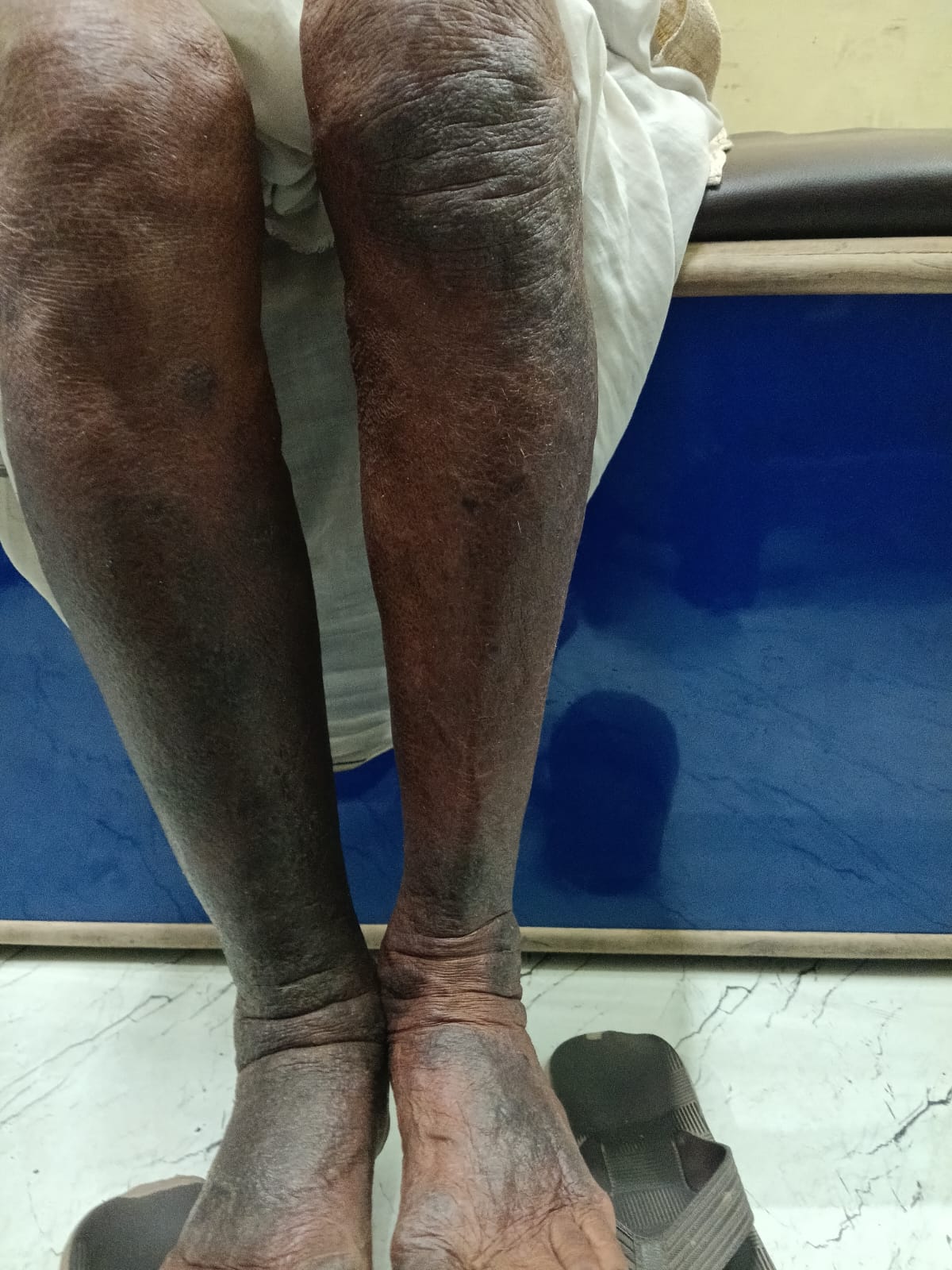 Patient condition during treatment documentation